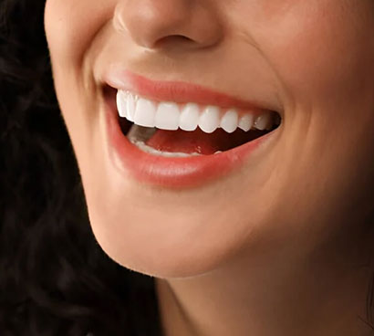 Smile Makeovers