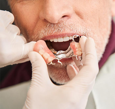 Our Dentures Process