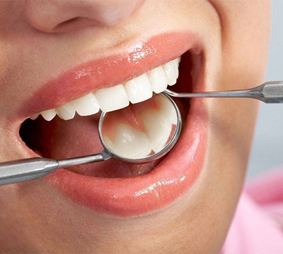 Fillings That Actually Match Your Teeth