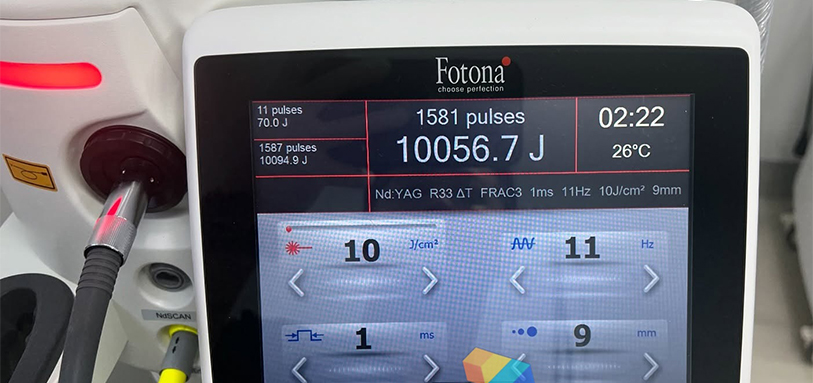 WHAT IS THE FOTONA LASER USED FOR?