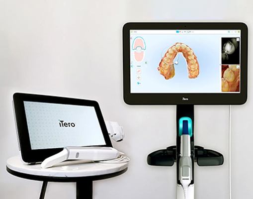 What Is the iTero Digital Scanner And How Is It Different?