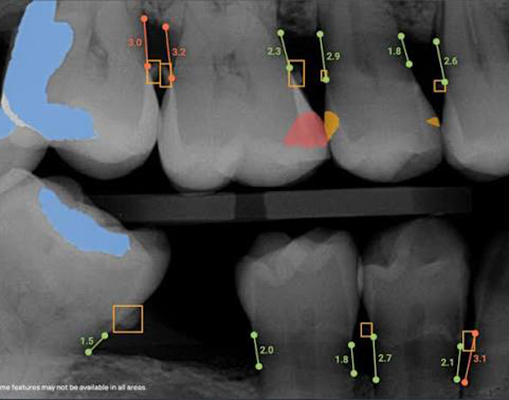 Why Does It Matter for Your Teeth?